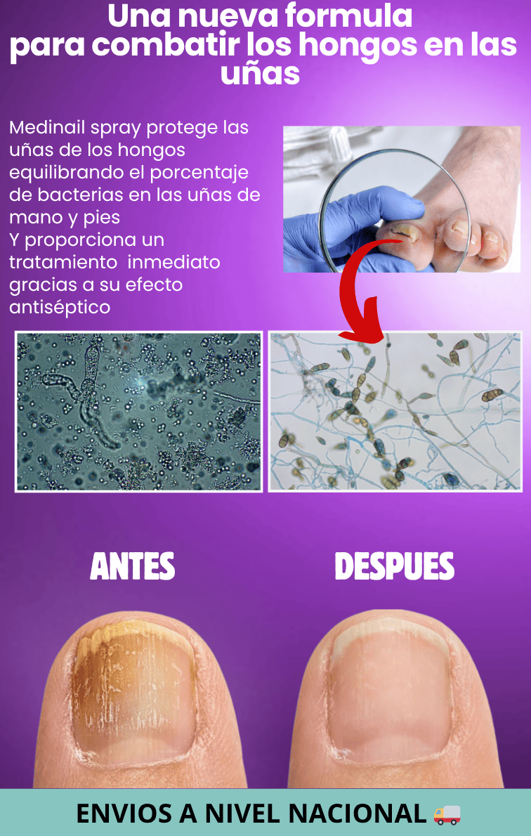 MEDINAIL-Spray Para los Hongos