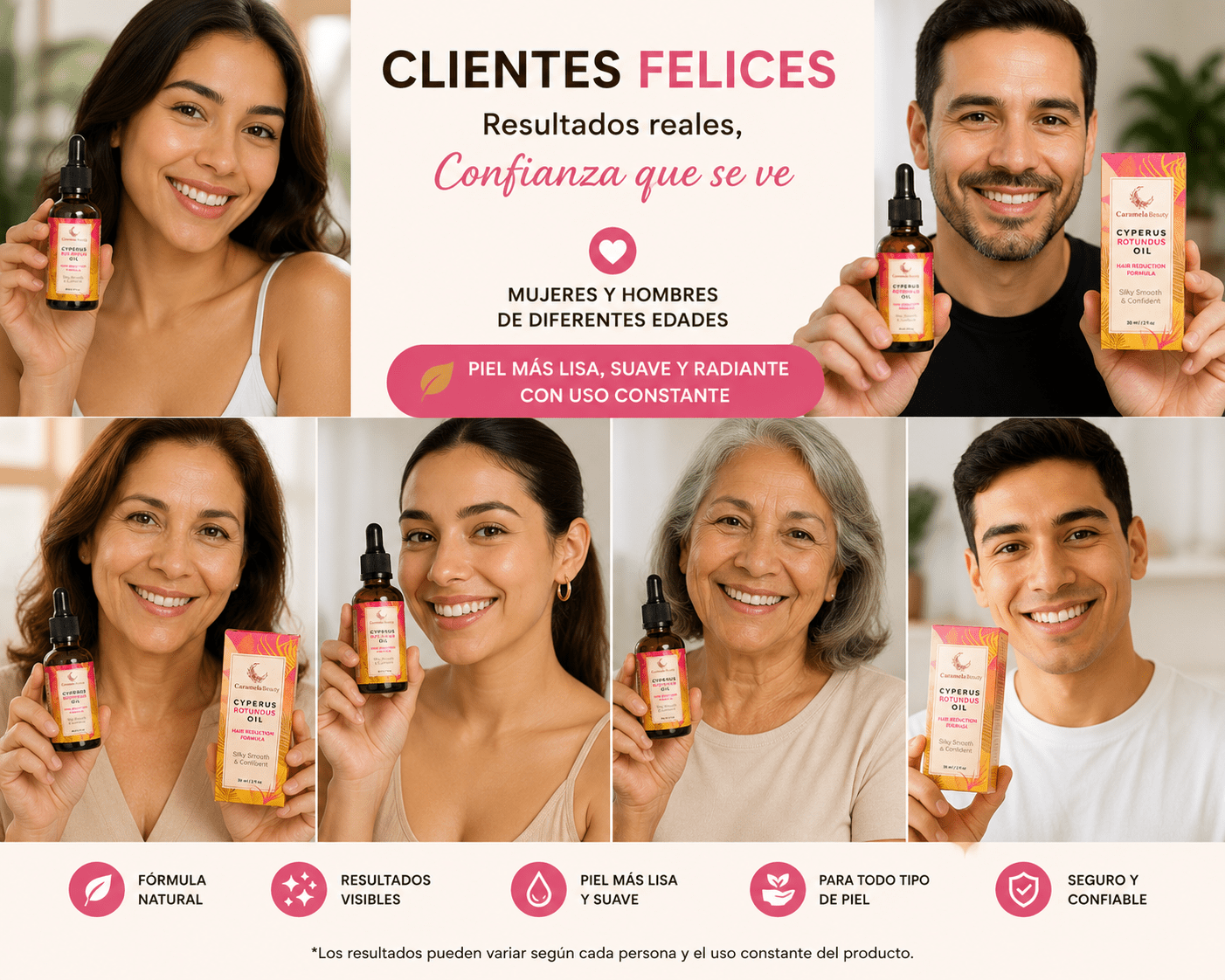 🇺🇸 Cyperus Rotundus Oil™ Aceite Reductor de Vello | Fórmula Premium - ALI SHOP